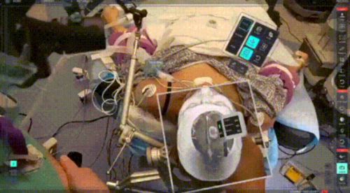 口腔诊疗的智能革新 当金属探测仪器制造引领精准医疗新趋势